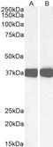 Arginase 1 antibody, abx430962, Abbexa, Western Blot image 