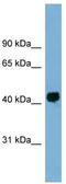 GPALPP Motifs Containing 1 antibody, TA344848, Origene, Western Blot image 