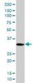 Protein Phosphatase 1 Regulatory Subunit 3B antibody, H00079660-B01P, Novus Biologicals, Western Blot image 