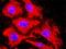 Inhibin Subunit Beta B antibody, H00003625-D01P, Novus Biologicals, Proximity Ligation Assay image 