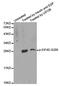 Eukaryotic Translation Initiation Factor 4E antibody, MBS128425, MyBioSource, Western Blot image 