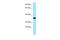 Folate Receptor Beta antibody, A04574, Boster Biological Technology, Western Blot image 