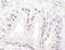 ATM Serine/Threonine Kinase antibody, NB100-678, Novus Biologicals, Immunohistochemistry paraffin image 