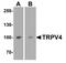 Transient Receptor Potential Cation Channel Subfamily V Member 4 antibody, NBP2-41262, Novus Biologicals, Western Blot image 