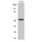 Transforming Growth Factor Beta Receptor 1 antibody, LS-C386397, Lifespan Biosciences, Western Blot image 