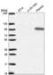 Gelsolin antibody, NBP2-55565, Novus Biologicals, Western Blot image 