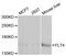 Fms Related Tyrosine Kinase 4 antibody, LS-C748361, Lifespan Biosciences, Western Blot image 