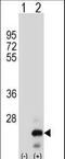 TNF Superfamily Member 18 antibody, LS-C160075, Lifespan Biosciences, Western Blot image 