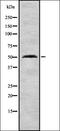 C-X-C Motif Chemokine Receptor 6 antibody, orb335156, Biorbyt, Western Blot image 