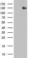 ADAM Metallopeptidase With Thrombospondin Type 1 Motif 1 antibody, NBP2-46492, Novus Biologicals, Western Blot image 