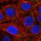 Proteasome 26S Subunit, Non-ATPase 6 antibody, PA5-57870, Invitrogen Antibodies, Immunofluorescence image 