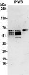 Thymine DNA Glycosylase antibody, NBP2-32248, Novus Biologicals, Immunoprecipitation image 
