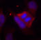 Protein Phosphatase 1 Regulatory Inhibitor Subunit 1B antibody, STJ22337, St John