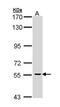 CDC73 antibody, PA5-29114, Invitrogen Antibodies, Western Blot image 