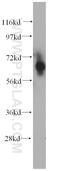 Chromatin Licensing And DNA Replication Factor 1 antibody, 14382-1-AP, Proteintech Group, Western Blot image 
