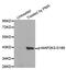 Mitogen-Activated Protein Kinase Kinase 3 antibody, MBS128488, MyBioSource, Western Blot image 