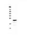 CD3 antibody, A02675, Boster Biological Technology, Western Blot image 