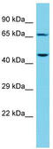 CTTNBP2 N-Terminal Like antibody, TA331846, Origene, Western Blot image 