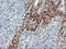 LIM Domain Kinase 1 antibody, LS-C172997, Lifespan Biosciences, Immunohistochemistry paraffin image 