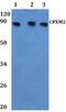 Carboxypeptidase X, M14 Family Member 2 antibody, PA5-75876, Invitrogen Antibodies, Western Blot image 