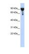 Exocyst Complex Component 3 antibody, NBP1-55109, Novus Biologicals, Western Blot image 