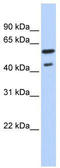 Thyroid Hormone Receptor Beta antibody, TA335178, Origene, Western Blot image 