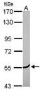 Coronin 2A antibody, GTX114879, GeneTex, Western Blot image 