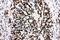 X-Ray Repair Cross Complementing 5 antibody, PA1641, Boster Biological Technology, Immunohistochemistry frozen image 