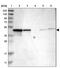 NDRG Family Member 3 antibody, PA5-53766, Invitrogen Antibodies, Western Blot image 