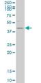 Histone Deacetylase 8 antibody, H00055869-M01, Novus Biologicals, Western Blot image 