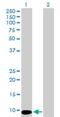 C-X9-C Motif Containing 4 antibody, H00004515-B01P, Novus Biologicals, Western Blot image 