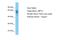 Ubiquitin Specific Peptidase 14 antibody, A30326, Boster Biological Technology, Western Blot image 