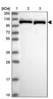Pre-MRNA Processing Factor 6 antibody, PA5-61428, Invitrogen Antibodies, Western Blot image 