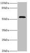 tRNA-splicing endonuclease subunit Sen2 antibody, orb352649, Biorbyt, Western Blot image 