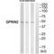 G Protein Regulated Inducer Of Neurite Outgrowth 2 antibody, A13614, Boster Biological Technology, Western Blot image 