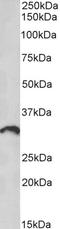 Protocadherin 11 Y-Linked antibody, STJ72076, St John