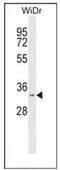 Retinal short-chain dehydrogenase/reductase 2 antibody, AP52109PU-N, Origene, Western Blot image 