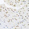 Histone Deacetylase 4 antibody, 13-068, ProSci, Immunohistochemistry paraffin image 