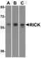 Receptor Interacting Serine/Threonine Kinase 2 antibody, A00818, Boster Biological Technology, Western Blot image 
