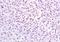 Checkpoint Kinase 2 antibody, orb10382, Biorbyt, Immunohistochemistry paraffin image 