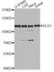 Discs Large MAGUK Scaffold Protein 1 antibody, A8542, ABclonal Technology, Western Blot image 