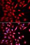 Proteasome 26S Subunit, ATPase 3 antibody, LS-C331808, Lifespan Biosciences, Immunofluorescence image 