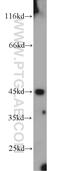 Inositol-Tetrakisphosphate 1-Kinase antibody, 10568-1-AP, Proteintech Group, Western Blot image 