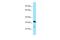 C-Type Lectin Domain Family 4 Member D antibody, A09880, Boster Biological Technology, Western Blot image 