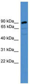 Armadillo Repeat Containing 8 antibody, TA335119, Origene, Western Blot image 