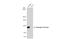 Androgen Receptor antibody, GTX100056, GeneTex, Western Blot image 