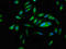 Patatin Like Phospholipase Domain Containing 6 antibody, LS-C671712, Lifespan Biosciences, Immunofluorescence image 