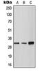 Tryptase Gamma 1 antibody, MBS820842, MyBioSource, Western Blot image 