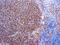 Alpha-1-antitrypsin antibody, GTX20922, GeneTex, Immunohistochemistry paraffin image 
