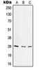 Integrin Subunit Alpha 6 antibody, orb214113, Biorbyt, Western Blot image 